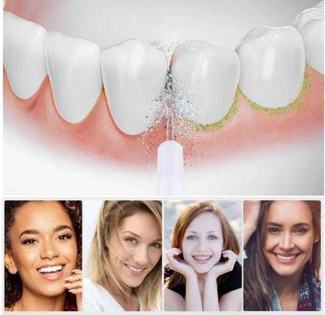 Irrigador Bucal POWER FLOSS